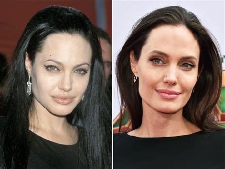 13 Celebrity Eyebrow Transformations