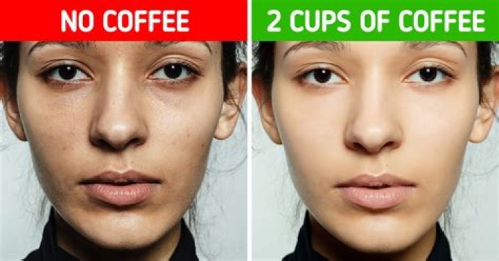 Does Drinking Too Much Coffee Cause Wrinkles?