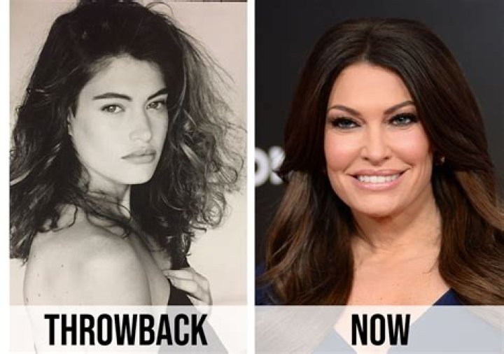 Kim Guilfoyle Plastic Surgery: A Comprehensive Analysis