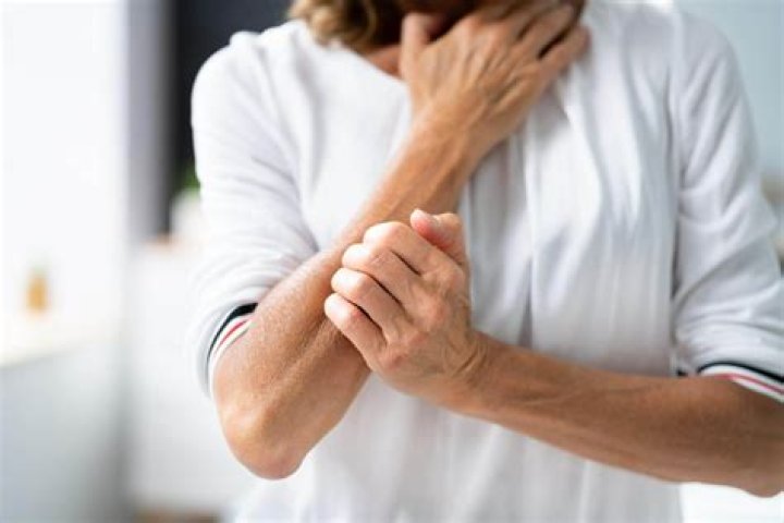 Makeup Application Tips for Psoriasis-Prone Skin